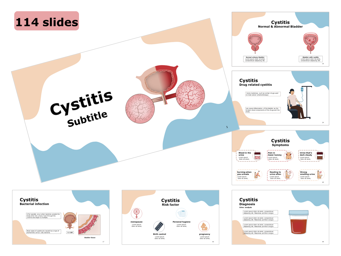 cystitis-powerpoint-template-rxslides-the-largest-online-store-for